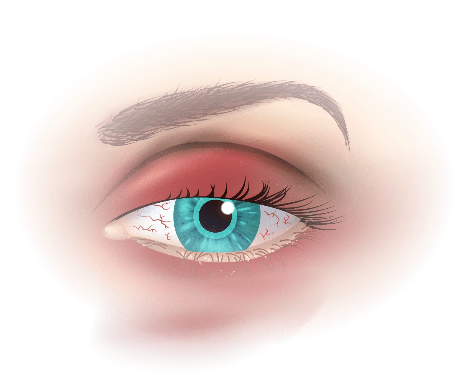Diagnostic en analyse clinique